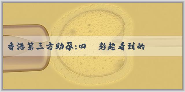 香港第三方助孕:四維彩超看到的寶寶是真實的嗎?
